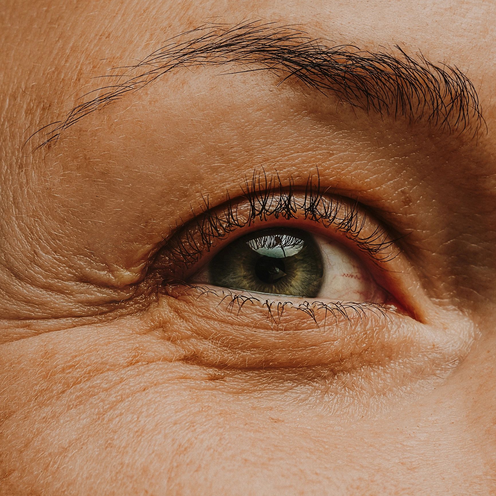 Eye area close-up showing skin texture and brow